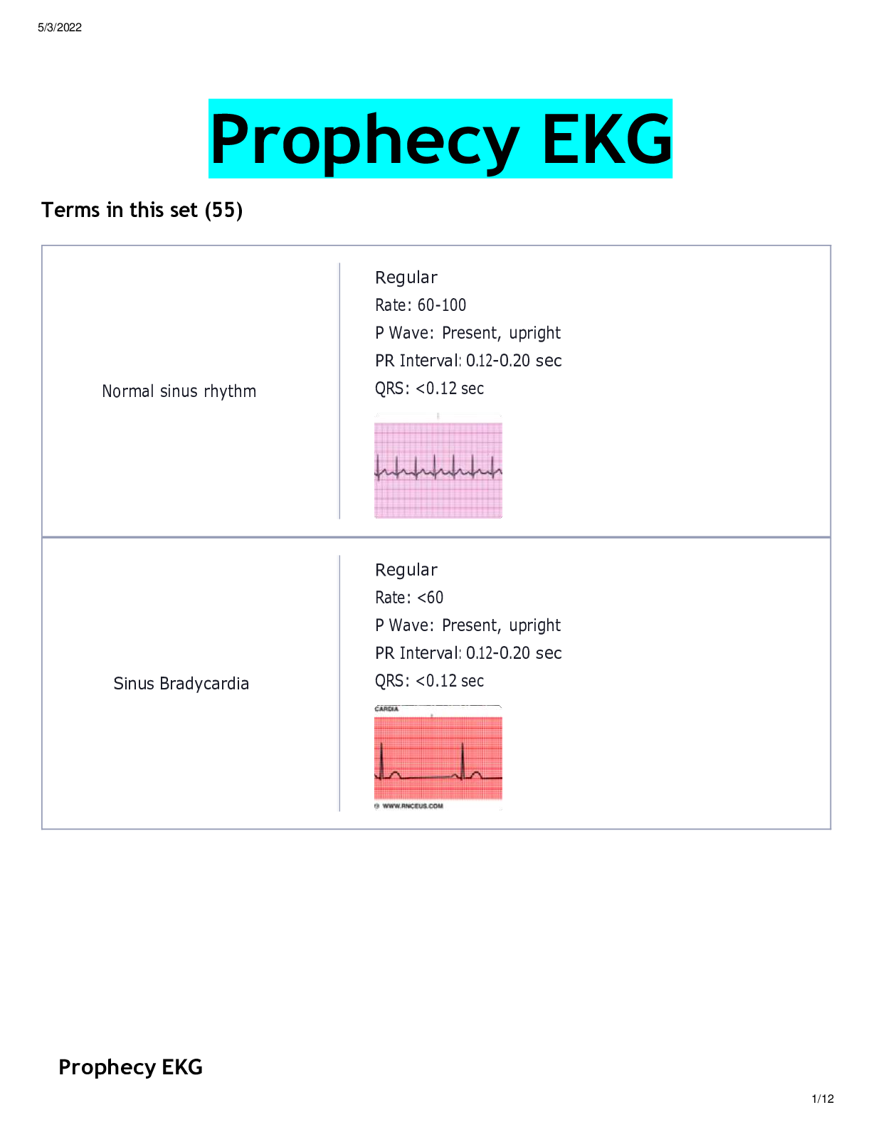 Preview image for Foundations of ECG Interpretation - Prophecy Health Complete/ Prophecy EKG complete Solution Latest Summer 2022.